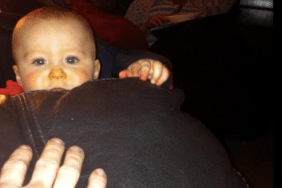Photo of baby with orange nose carotenoma